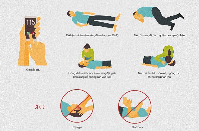 Một số hướng dẫn khi có người thân bị đột quỵ