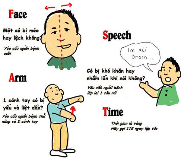 Cách kiểm tra người bị đột quỵ