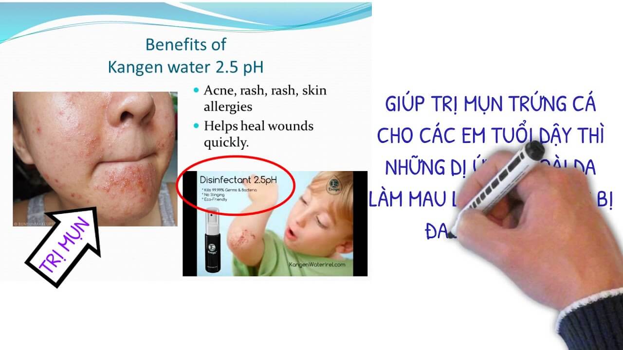 Nước kangen 2.5 dùng để sát trùng, diệt khuẩn, khử mùi