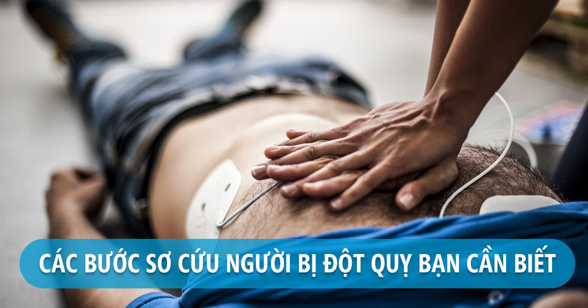 Các bước sơ cứu người bị đột quỵ cần biết