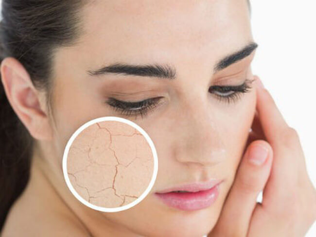 ĐIỀU GÌ SẼ XẢY RA KHI CƠ THỂ BỊ MẤT NƯỚC?- Nước điện giải Kangen