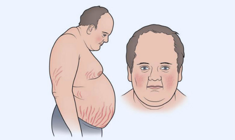Ung thư phổi- Mầm mống nguy hiểm ngầm